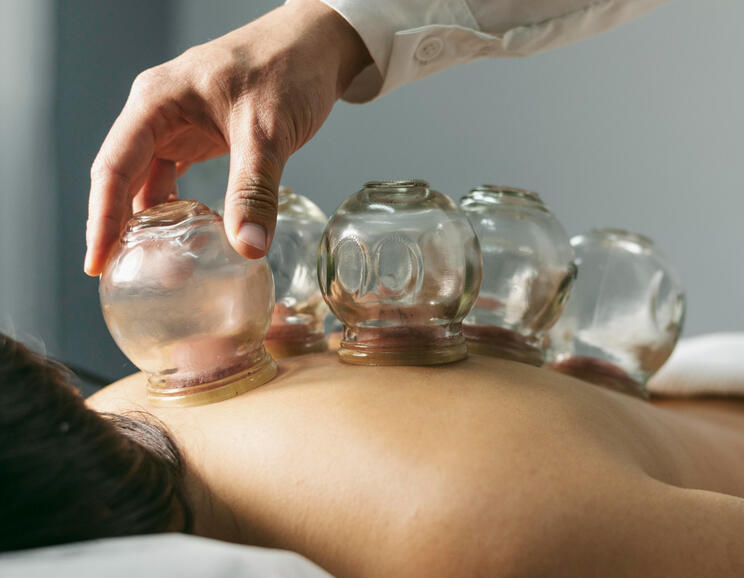 Cupping Therapy