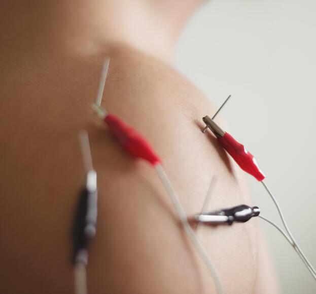 Electroacupuncture